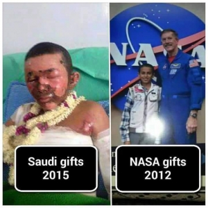 Two Different Gifts for Yemeni Boy in 3 Years