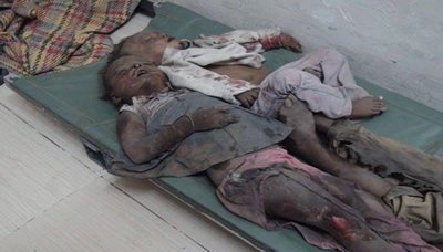 أطفال اليمن .. بين فكي العدوان والحصار