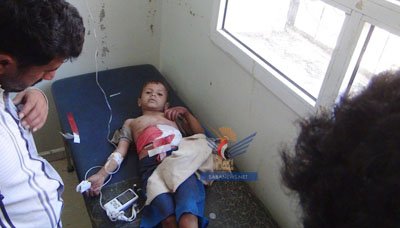 منظمة رعاية الأطفال: على العالم ألا يقف متفرجا على قصف الأطفال في اليمن