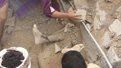 عام على العدوان..هنا اليمن والضمير العالمي في عطلة!
