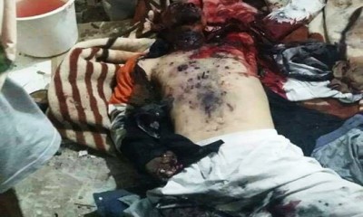 انفجار قنبلة في مطعم بصنعاء يسفر عن قتلى وجرحى