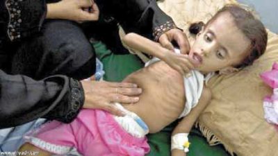 اتحاد نقابات عمال اليمن يطالب الأمم المتحدة بوقف العدوان ورفع الحصار الجائر