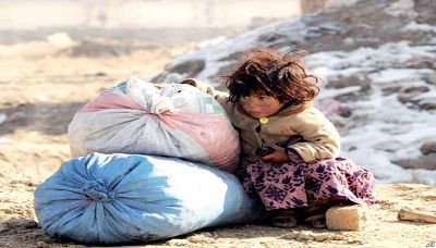 أطفال اليمن في ظل العدوان: أوبئة ..مجاعة ..سوء تغذية وكل أشكال الحرمان