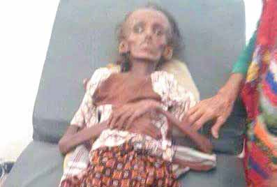 منظمات دولية: اليمن يعاني أسوأ كارثة إنسانية في العالم