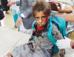 قصيدةُ الخُلْد.. شهداء مجزرة ضحيان