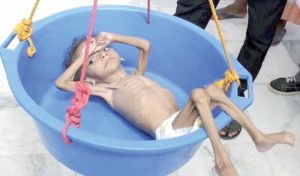 اطفال اليمن .. 1330 يوما من الإبادة!