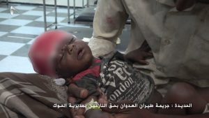 فرع مجلس الشؤون الإنسانية بالحديدة يدين جريمة استهداف العدوان لأسرة نازحة بحي الربصة في مديرية الحوك