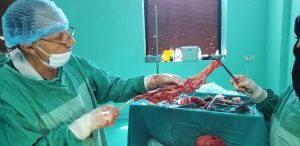 فريق طبي ينجح في استئصال كلية مريض بمستشفى 22 مايو بهمدان