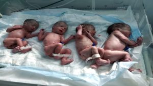 ولادة اربعة توائم في مستشفى السبعين بالعاصمة صنعاء