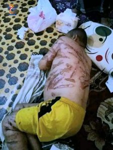 السلطة المحلية في إب تدين جريمة تعذيب وقتل المواطن محمد مهدي من قبل مرتزقة العدوان