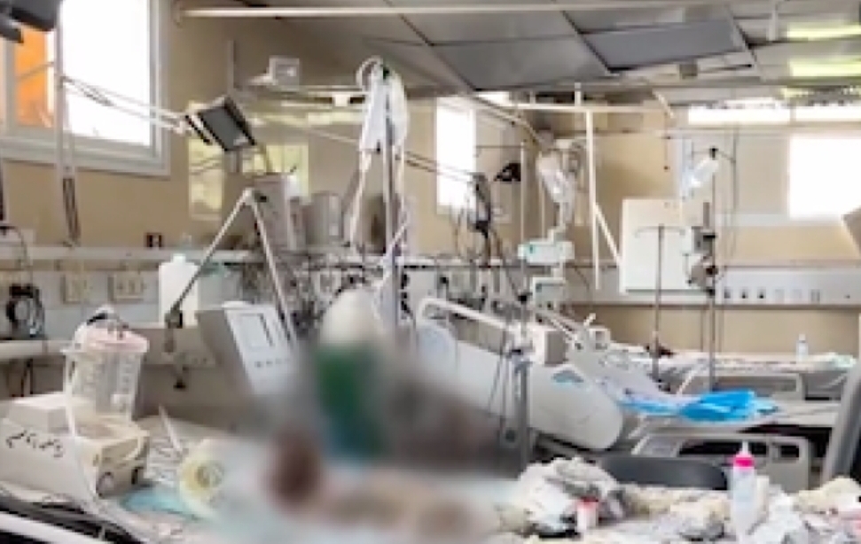 الأورومتوسطي : وفاة طفل بسبب نقص الغذاء في مستشفى الشفاء بغزة
