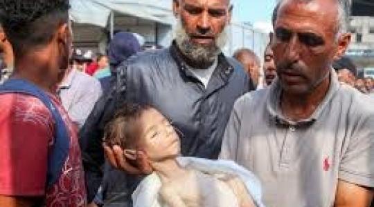 ارتفاع عدد وفيات حرب التجويع إلى 122 بوفاة تسع حالات اليوم في غزة