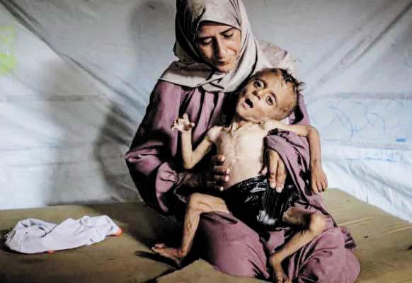 أمهات في غزة يُرضعن أطفالهن ماءً بدل الحليب