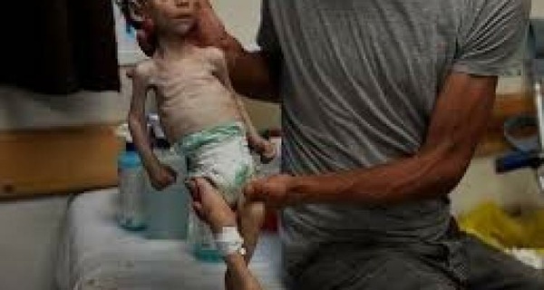 الدقران: العدو الإسرائيلي مصمم على عدم إدخال حليب الأطفال إلى غزة