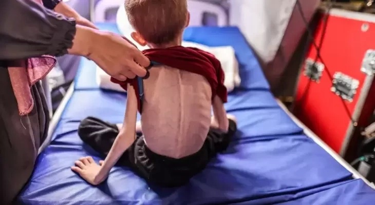 “المستشار الإعلامي لأونروا”: لم يتغير شيء بعد إعلان دخول غزة مرحلة المجاعة