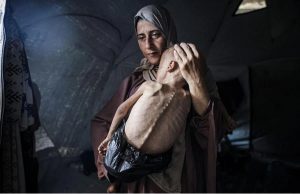 الصحة بغزة : ثلاث حالات وفاة نتيجة المجاعة خلال الـ24 ساعة الماضية