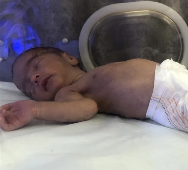 مجمع الناصر الطبي بغزة : وفاة 13 طفلاً بينهم عشرة أجنة خلال 24 ساعة