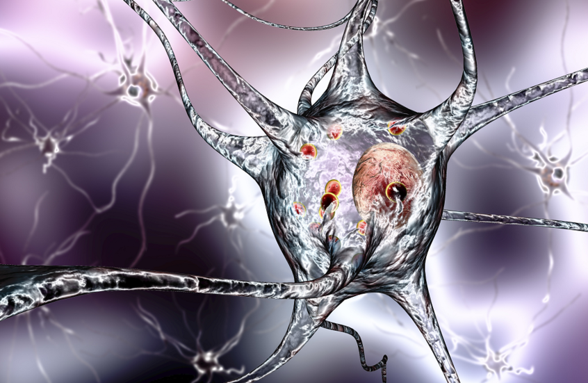 دراسة: دواء شائع للهربس قد يفاقم ألزهايمر المبكر