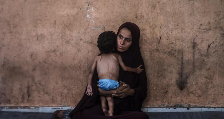 “الأونروا”: 508 أطفال في غزة يعانون من سوء تغذية حاد