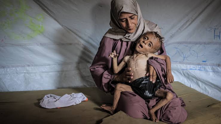 4 من كل 5 أطفال في غزة يواجهون مستويات جوع كارثية