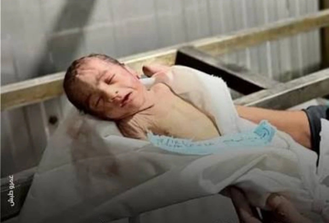 أطباء بلا حدود: وفاة رضيع في مستشفى ناصر بغزة بسبب البرد القارس ونقص مقومات البقاء