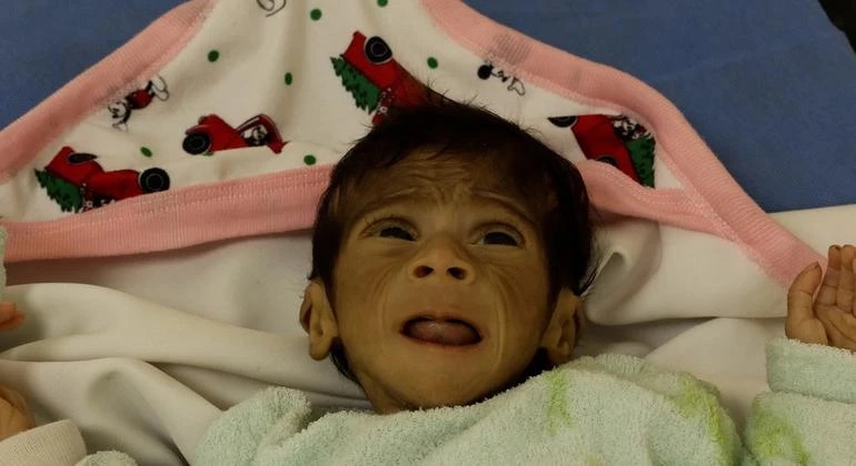 “يونيسف” تحذر من تفشي الأمراض بين أطفال غزة وتدعو لتكثيف المساعدات الإنسانية