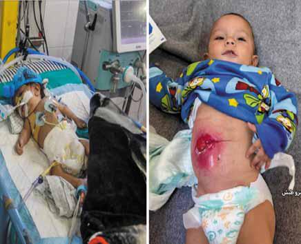 أطفال على حافة الموت.. مرضى غزة يدفعون ثمن إغلاق المعابر