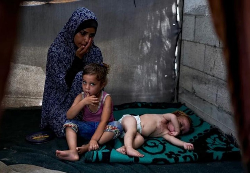 “الصحة” في غزة: واقع بيئي وصحي كارثي وانتشار واسع للأمراض في مراكز الإيواء