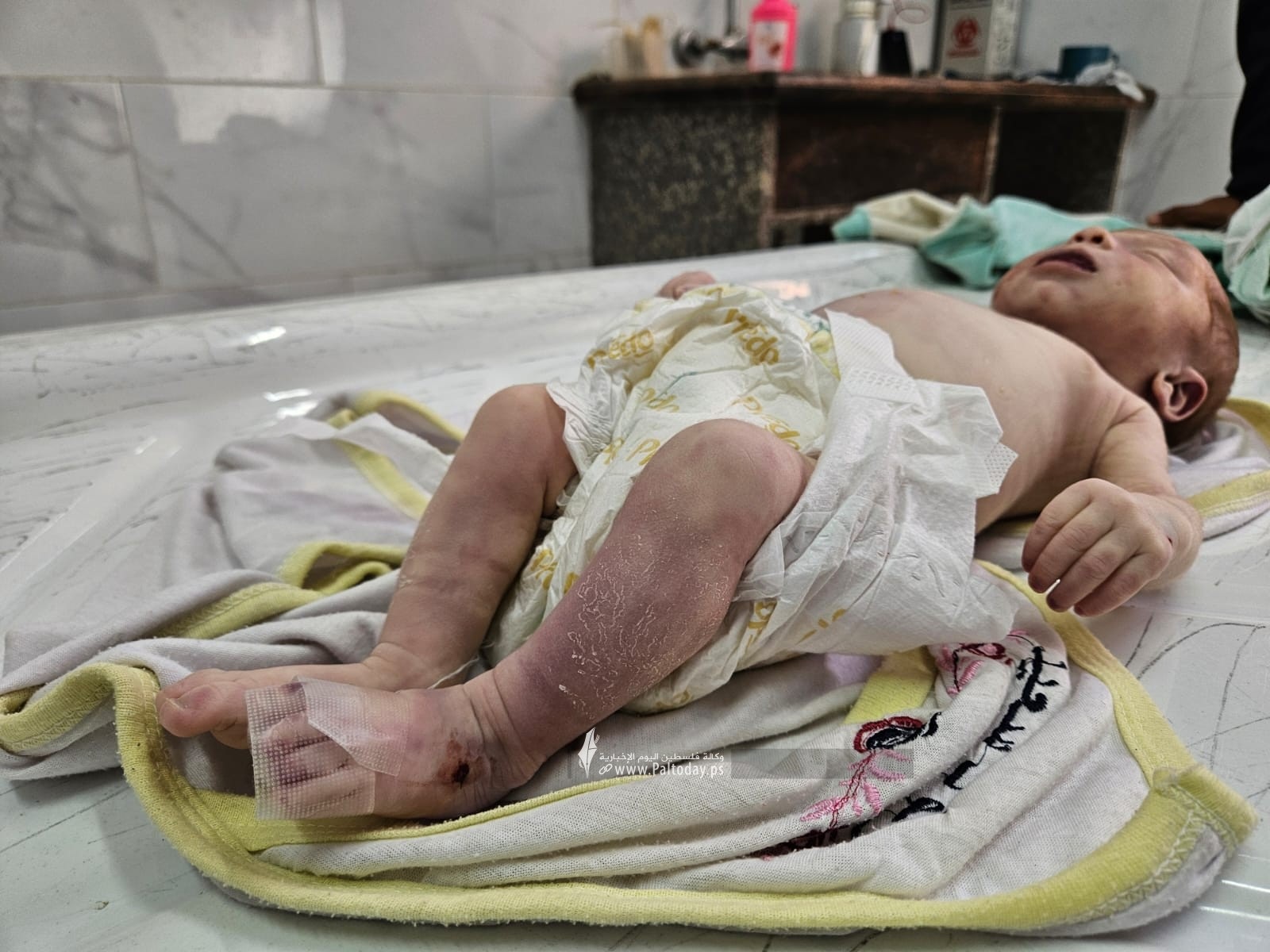 وفاة رضيعة فلسطينية نتيجة البرد القارس في خان يونس جنوب غزة