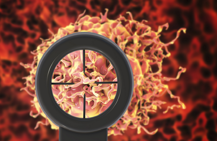 نهج روسي جديد لعلاج السرطان بالضوء