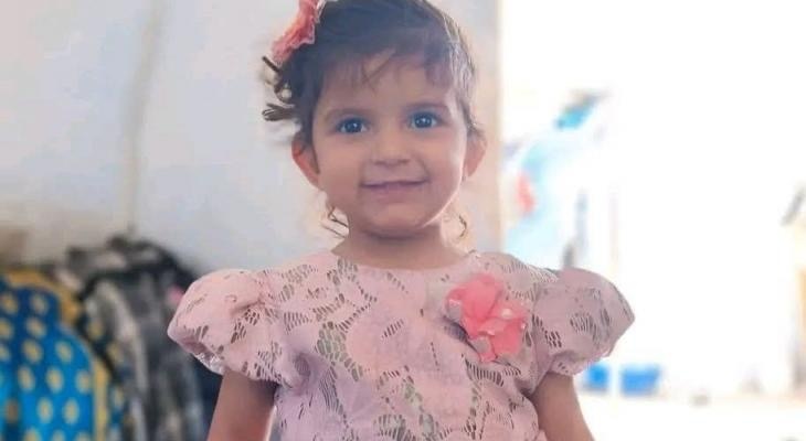 استشهاد طفلة فلسطينية في غزة متأثرة بإصابتها في قص