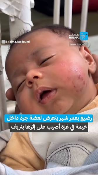 أبو سليمة: مليون ونصف نازح في غزة يواجهون ظروفًا إنسانية وصحية قاسية